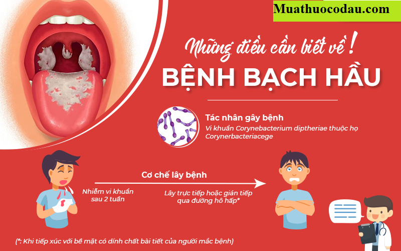 benhbachhau Bệnh Bạch hầu, nguyên nhân triệu chứng và cách điều trị